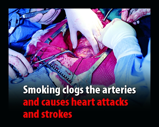 causes of smoking. Smoking cessation and