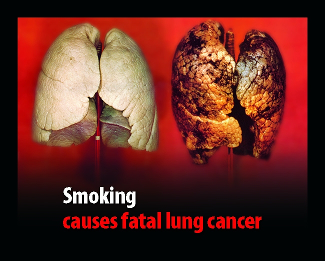 fatal-lung-cancer.jpg
